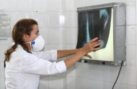 Exame para detectar tuberculose torna diagnóstico 100% mais rápido