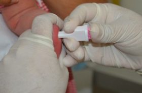 Teste do Pezinho detecta até seis doenças, alerta especialista médica da Saúde