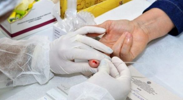 Em 32 anos, Estado de Alagoas registra mais de 6.800 casos diagnosticados de Aids