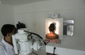 Exames por Radiodiagnóstico beneficiam população de Porto Calvo