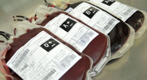 Hemoal Trapiche suspende coleta de sangue nesta segunda (14) para manutenção da rede elétrica