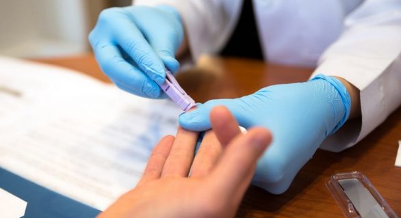 Dezembro Vermelho: Hospital Helvio Auto oferece testes de HIV nesta sexta-feira (6)