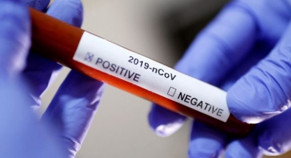Sesau confirma resultado positivo para caso de coronavírus em AL