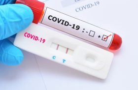 Planos de saúde serão obrigados a cobrir testes para Covid-19