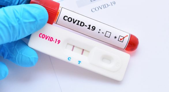 Planos de saúde serão obrigados a cobrir testes para Covid-19