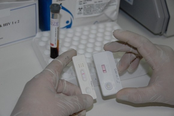 Saúde quer reverter quadro de infecção de DST/Aids em Unidades de Internação