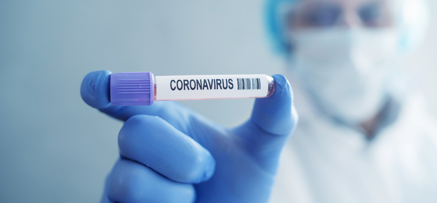 Brasil chega a 111.100 mortes confirmadas pelo novo coronavírus
